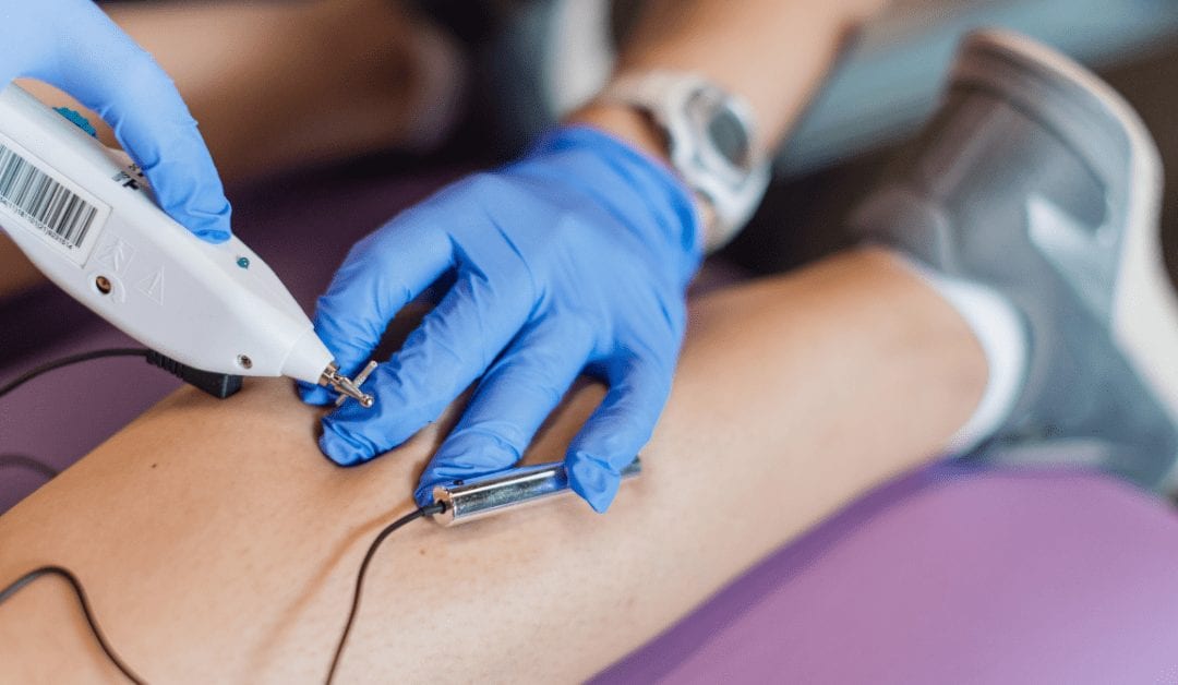 Dry Needling for Pain Relief