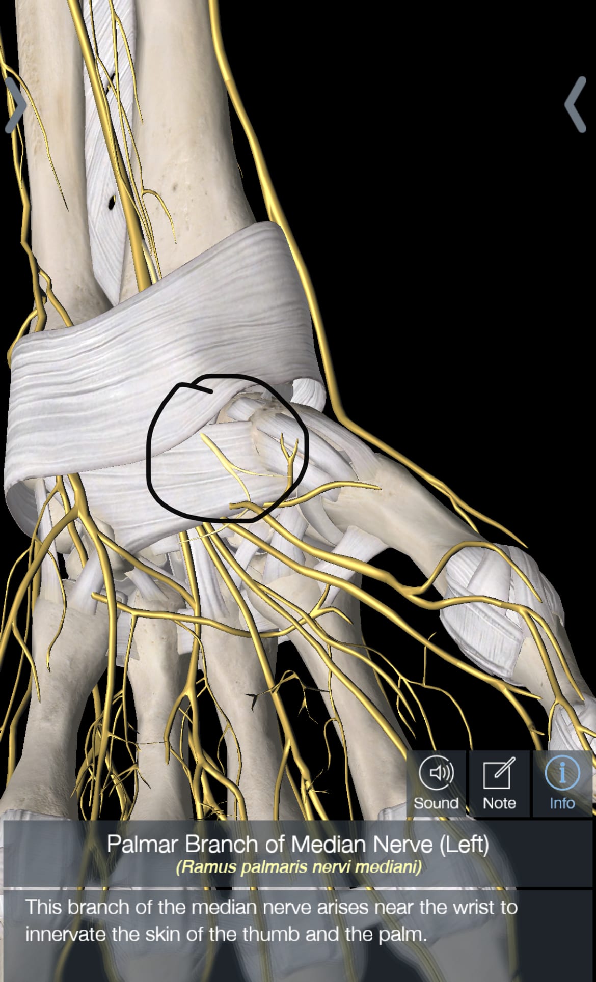 carpal tunnel carpal tunnel