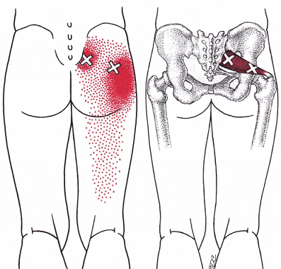 Piriformis Muscle Pain  Tailbone and Buttock Pain from Piriformis Mus