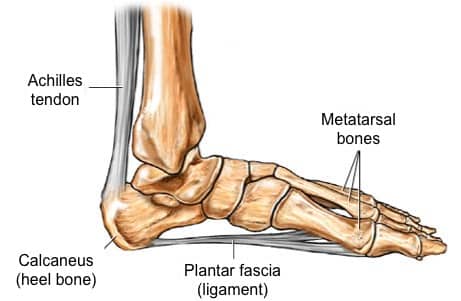 heel pain heel pain